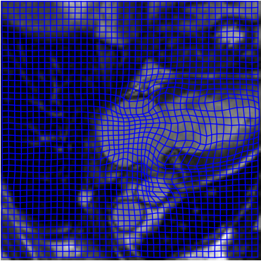 Samples of registered images on the left atrium data set with the corresponding deformation field grid (DF). The end-systolic (ES) frame is the moving image and end-diastolic (ED) frame is the fixed image. The warped ES of each row is shown in the third column. The last column labeled ground truth (GT) displays the true segmentation and the predicted segmentation, which are shown by the green line and blue line respectively. The 2ch, 3ch and 4ch stand for the 2, 3 and 4-chamber. 